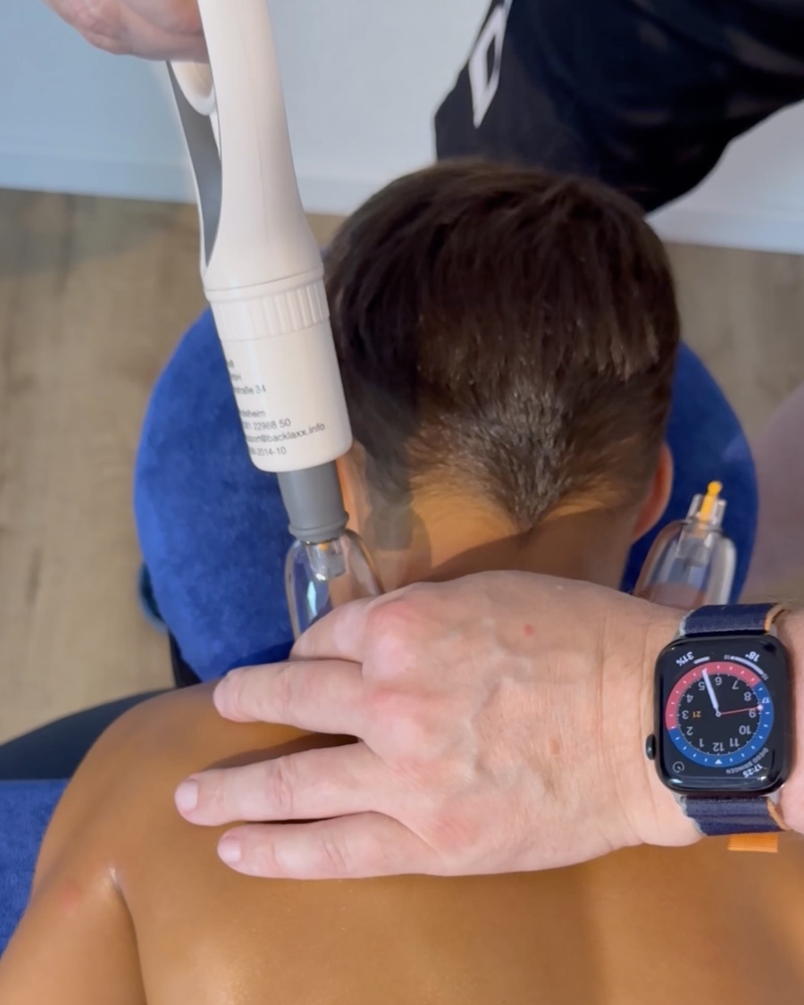 Sascha Göbl setzt beim Schröpfen einen Schröpfbecher am Rücken an.